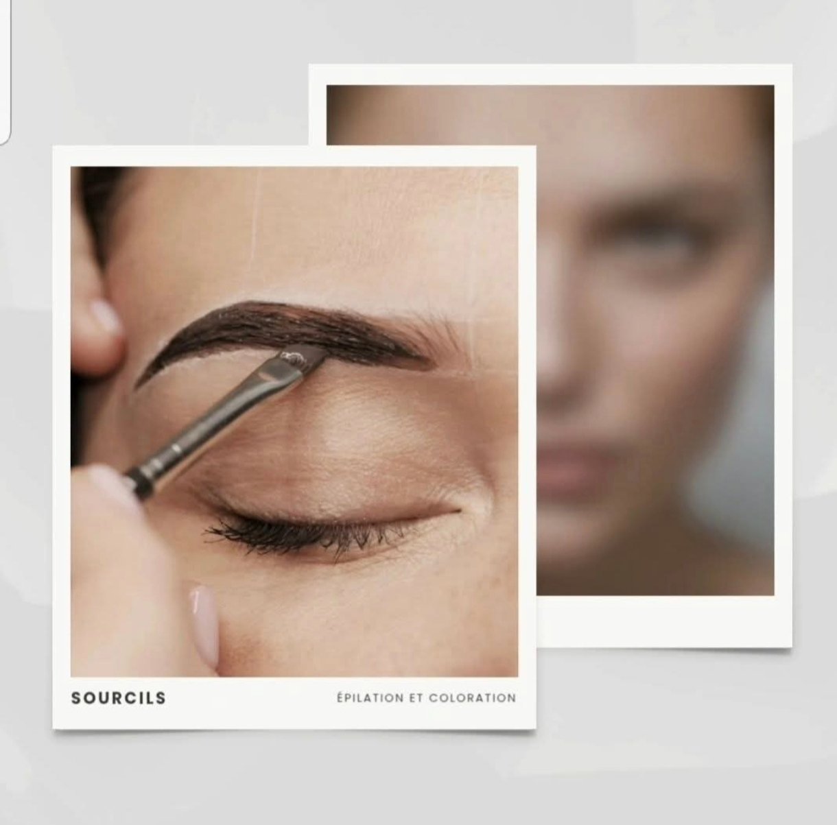 brow lift jumet